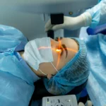 Lasik Mata: Solusi Permanen untuk Bebas Kacamata